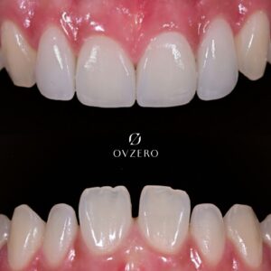 553044607_17885278095371492_4162916051755572304_n