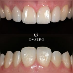 553199511_17885277444371492_7627668760468959362_n